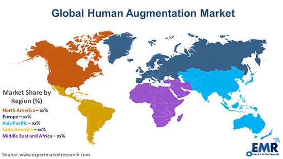 Global Human Augmentation Market By Region
