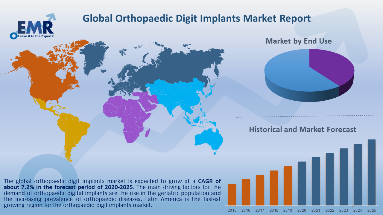 Orthopaedic Digit Implants Market Size, Share, Report & Forecast 20212026