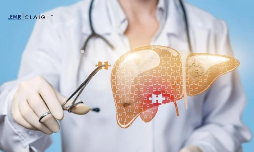 Top Companies in the Liver Disease Treatment Market