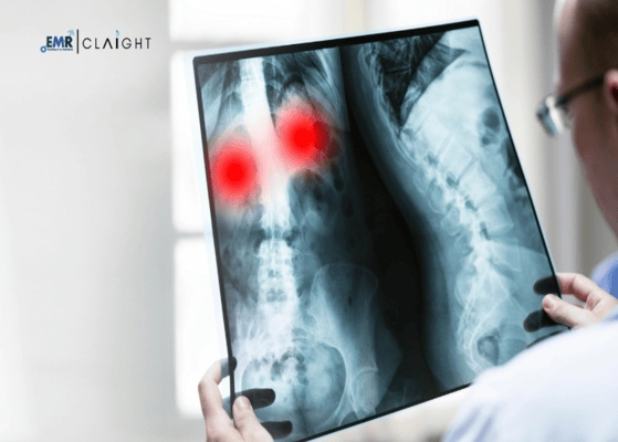 Top 6 Companies in the Global Medical X-ray Market